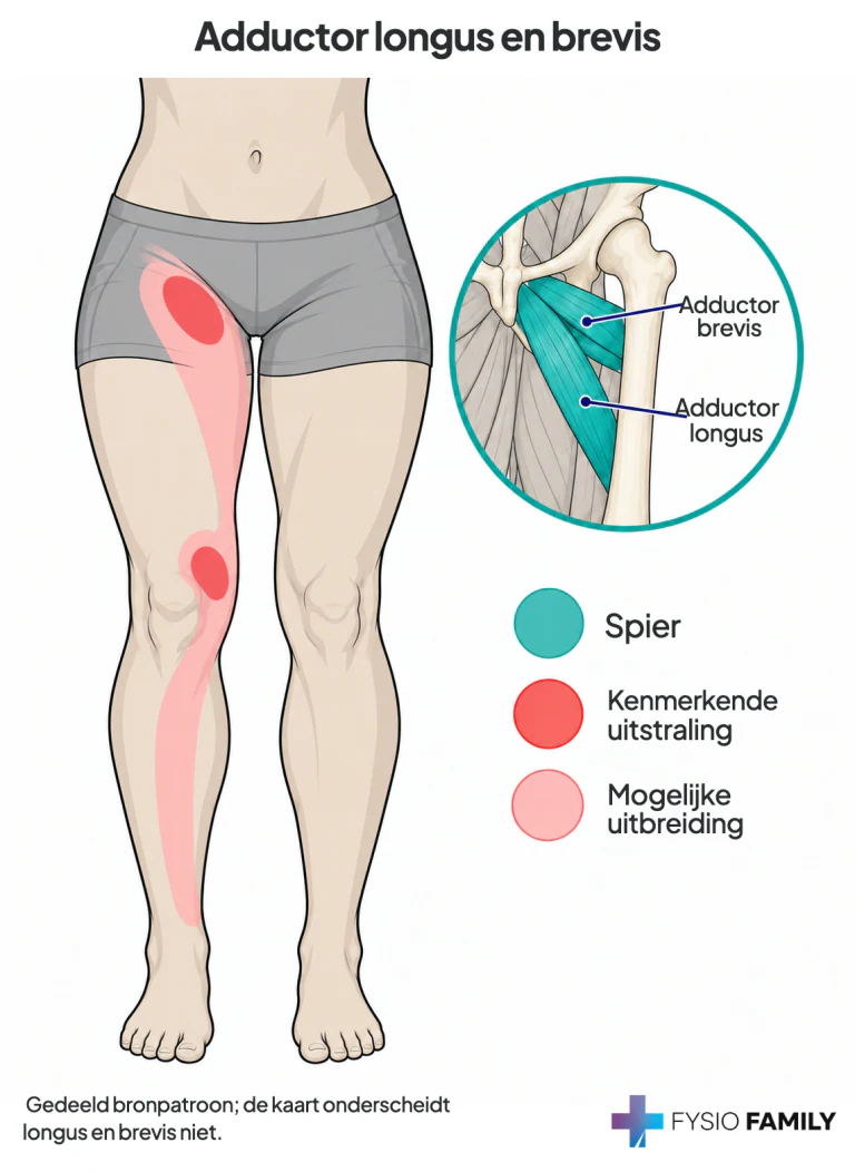 Gedeeld bronpatroon van adductor longus en brevis: lies en binnenknie, met mogelijke uitbreiding langs binnenbovenbeen en scheenbeen.