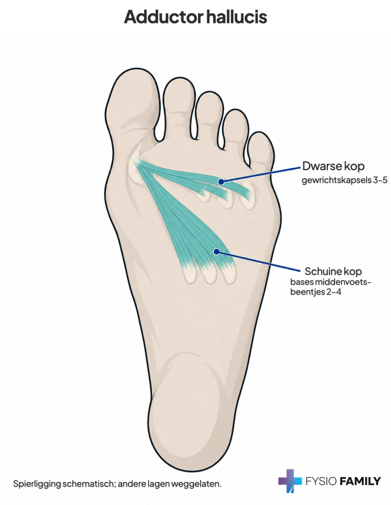 Adductor hallucis: de schuine kop loopt vanuit de bases van middenvoetsbeentjes 2–4 en de dwarse kop vanuit de kapsels van teengewrichten 3–5 naar de laterale basis van de grote teen. Schematische spierligging; andere lagen zijn weggelaten.