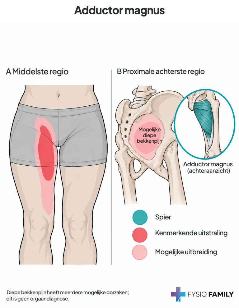 Adductor magnus: voor-binnenzijde bovenbeen vanuit de middelste regio en mogelijk diep bekkengebied vanuit de hoge achterste regio.