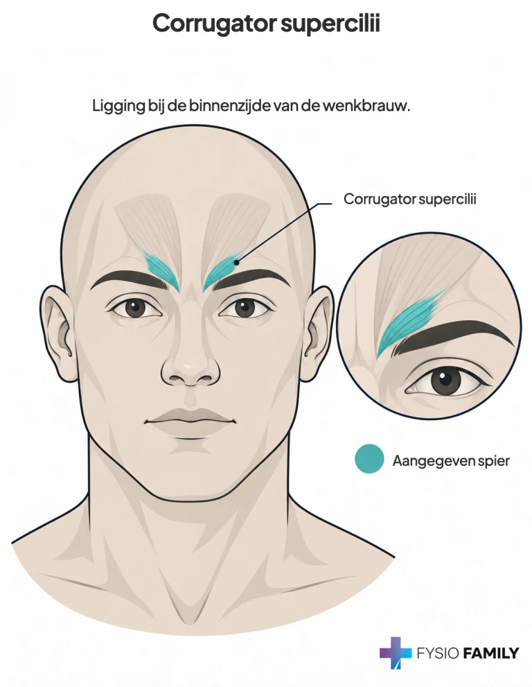 Eigen anatomische illustratie van de corrugator boven de binnenzijde van de wenkbrauw. De afbeelding toont de spierligging; er wordt geen afzonderlijke pijnkaart afgebeeld.