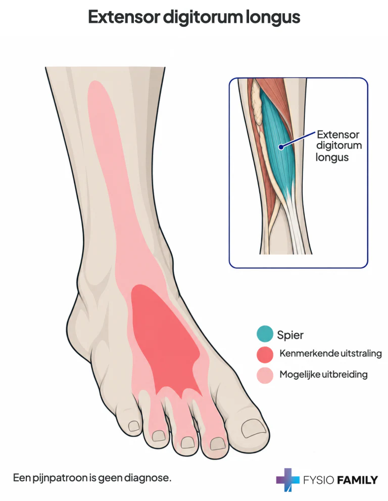 Extensor digitorum longus: centrale voetrug met mogelijke uitbreiding naar kleine tenen en voor-buitenzijde van het onderbeen.
