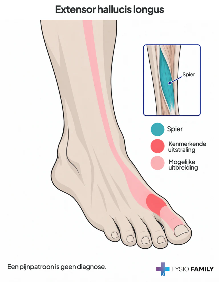 Extensor hallucis longus: bij het eerste middenvoetskopje en de grote-teenbasis aan de voetrugzijde; roze toont mogelijke uitbreiding.
