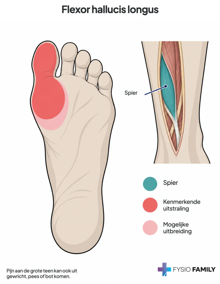 Flexor hallucis longus: voetzoolzijde van de grote teen en de bal eronder.