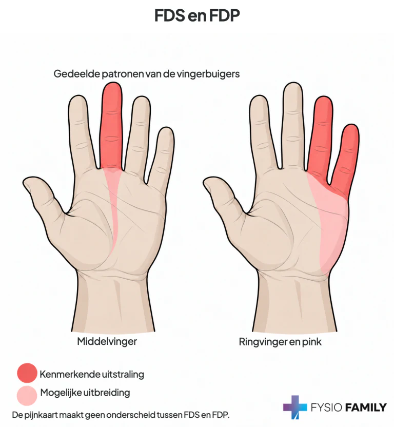Figuur 38.2B — gedeelde FDS/FDP-patronen naar de betrokken vingers. De bron maakt geen afzonderlijke pijnkaart voor superficialis en profundus.