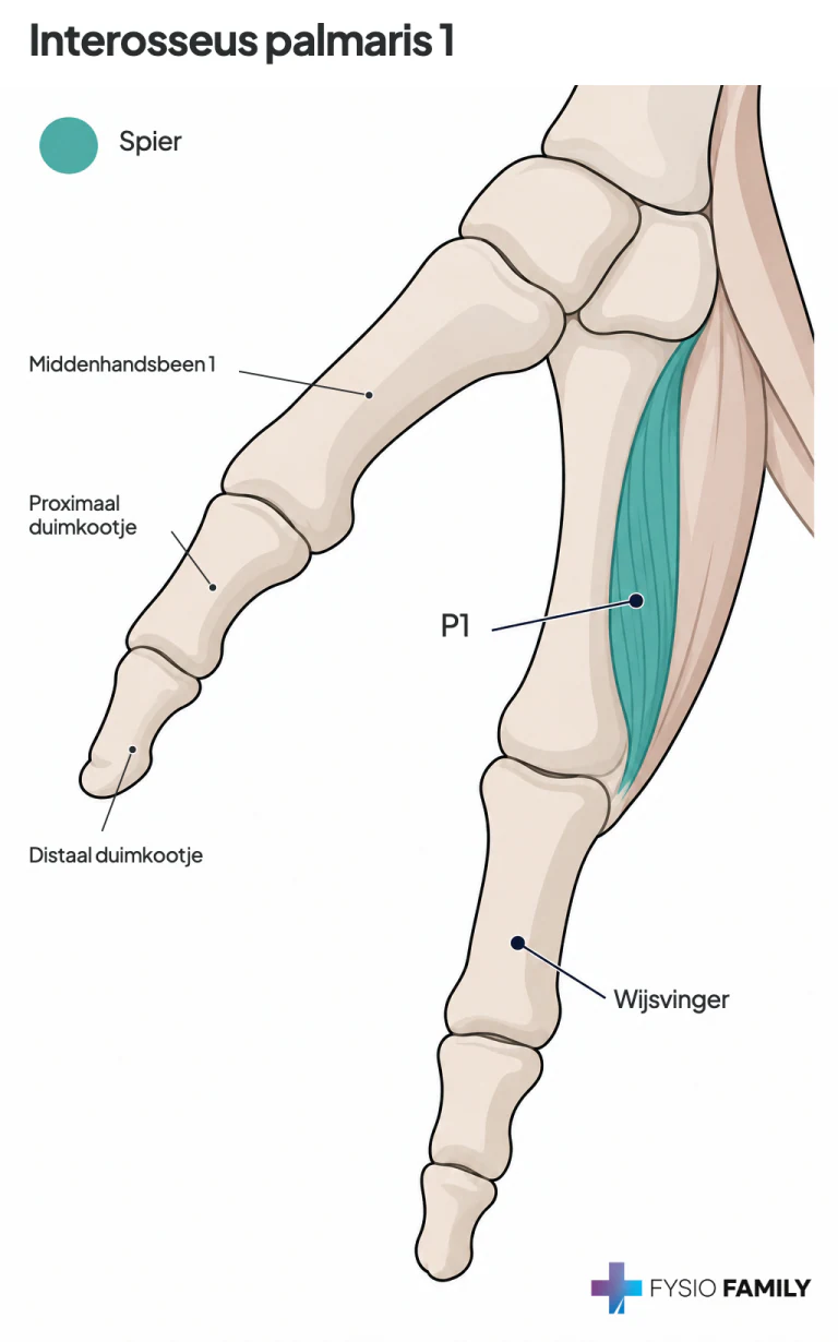 Figuur 40.1B — anatomische uitsnede met label P1 voor de 1e palmaire interosseus; geen individuele pijnkaart.
