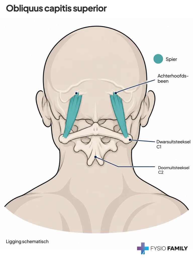 Figuur 17.1 — anatomische uitsnede met het label obliquus capitis superior. De omliggende structuren geven de ligging aan; dit is geen individuele pijnkaart.