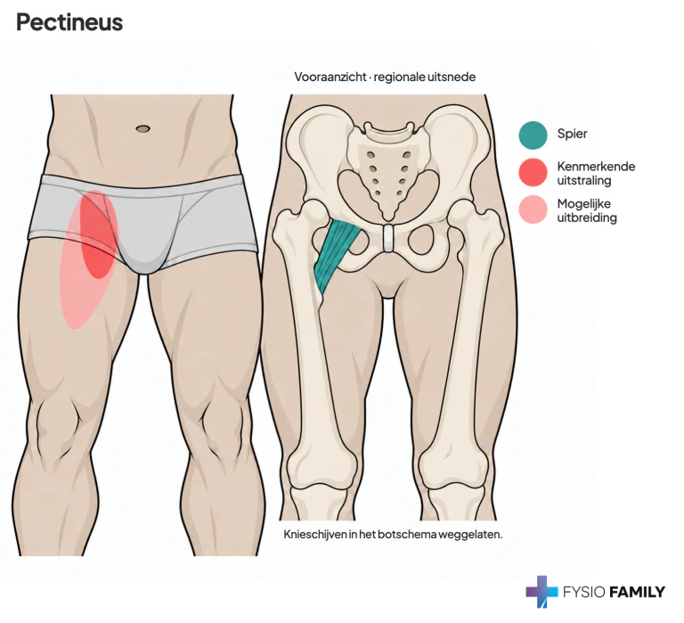 Pectineus: liesregio en bovenste voor-binnenzijde van het bovenbeen; korte spier tussen schaambeen en proximaal femur.