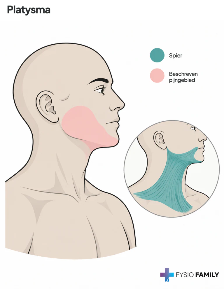 Figuur 13.3C — platysma met het oppervlakkige pijngebied onder de kaak.