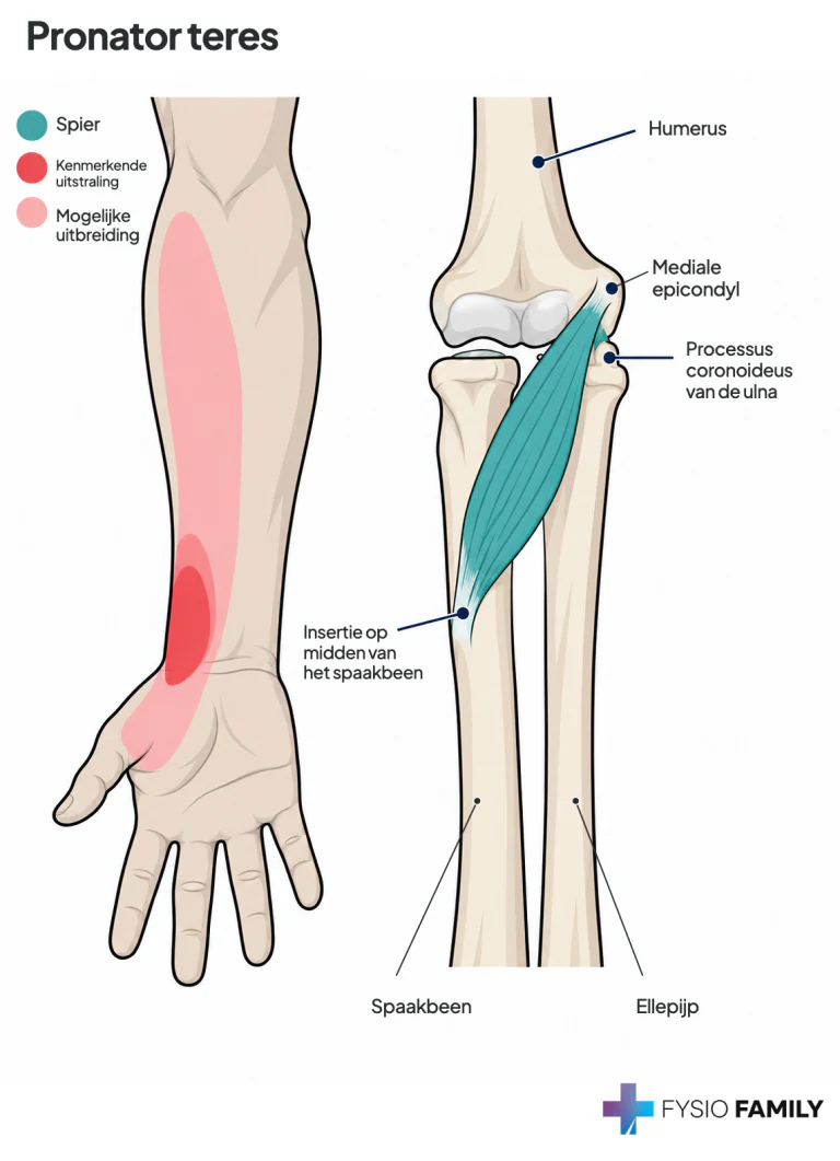 Figuur 38.2D — pronator teres en het eigen volaire onderarm-/polspatroon.