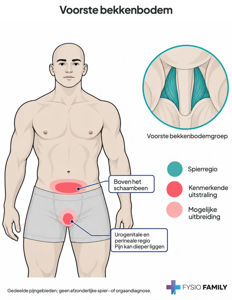 Voorste bekkenbodem: gedeelde suprapubische, urogenitale en perineale pijngebieden.