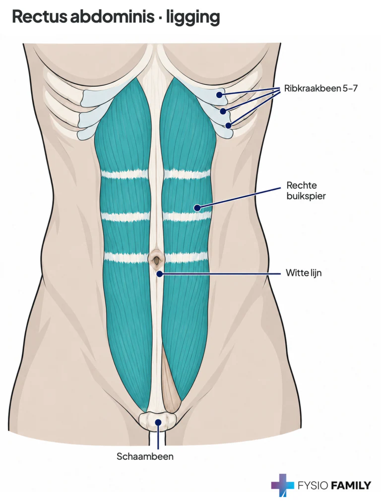 Figuur 49.4. Rectus abdominis met peesinscripties; de kleine pyramidalis staat onderaan ter oriëntatie.