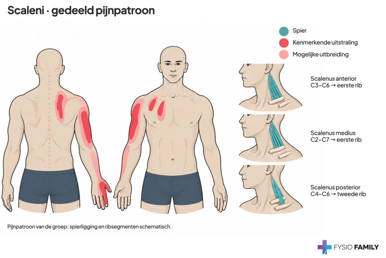 Gedeeld pijnpatroon van scalenus anterior, medius en posterior. Het boek geeft hier geen exclusieve kaart per spier. De kleine inzetten tonen de spierligging en ribaanhechtingen schematisch.