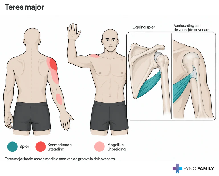 Teres major: voor- en achteraanzicht van het beschreven schouder- en armpijngebied, met aparte anatomische details van het spierverloop en de voorste bovenarmaanhechting.