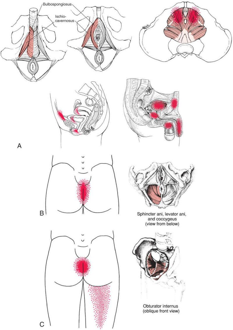 Bekkenbodemspieren - Afbeelding 3