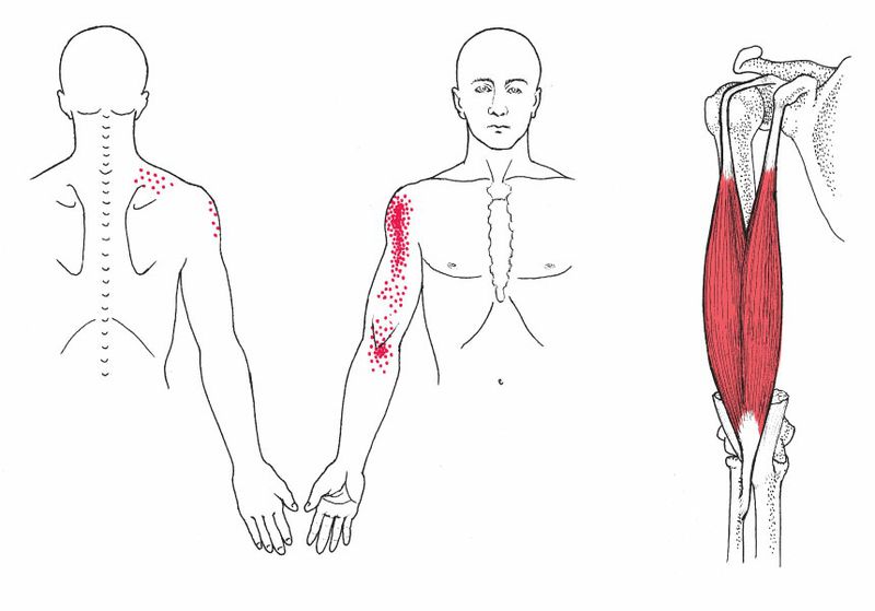 Biceps Brachii - Afbeelding 2