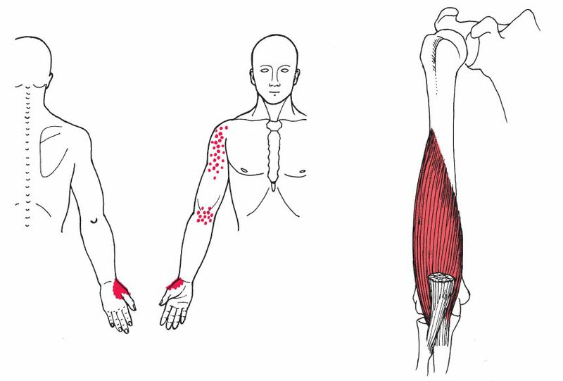 Brachialis - Afbeelding 2