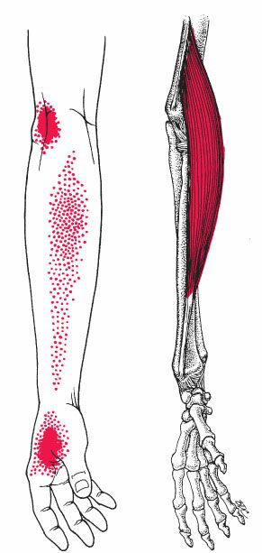 Brachioradialis - Afbeelding 5