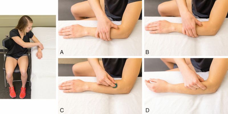 Brachioradialis - Afbeelding 8