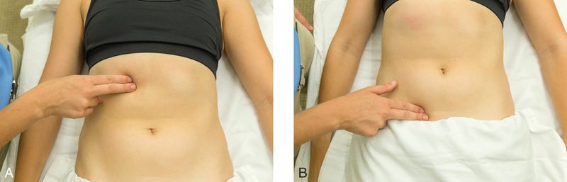 Buikspieren - Afbeelding 10