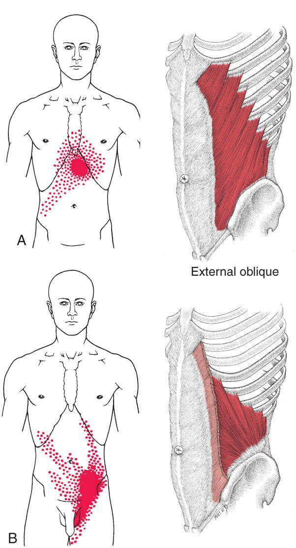 Buikspieren - Afbeelding 6