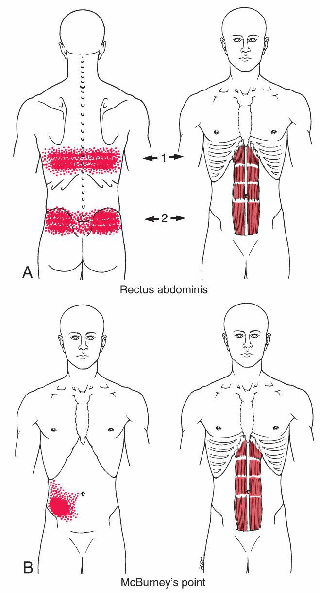 Buikspieren - Afbeelding 7