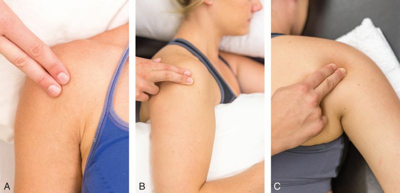 Deltoideus - Afbeelding 4