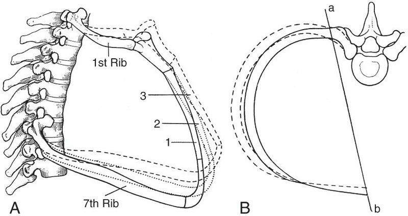 Diaphragma - Afbeelding 6