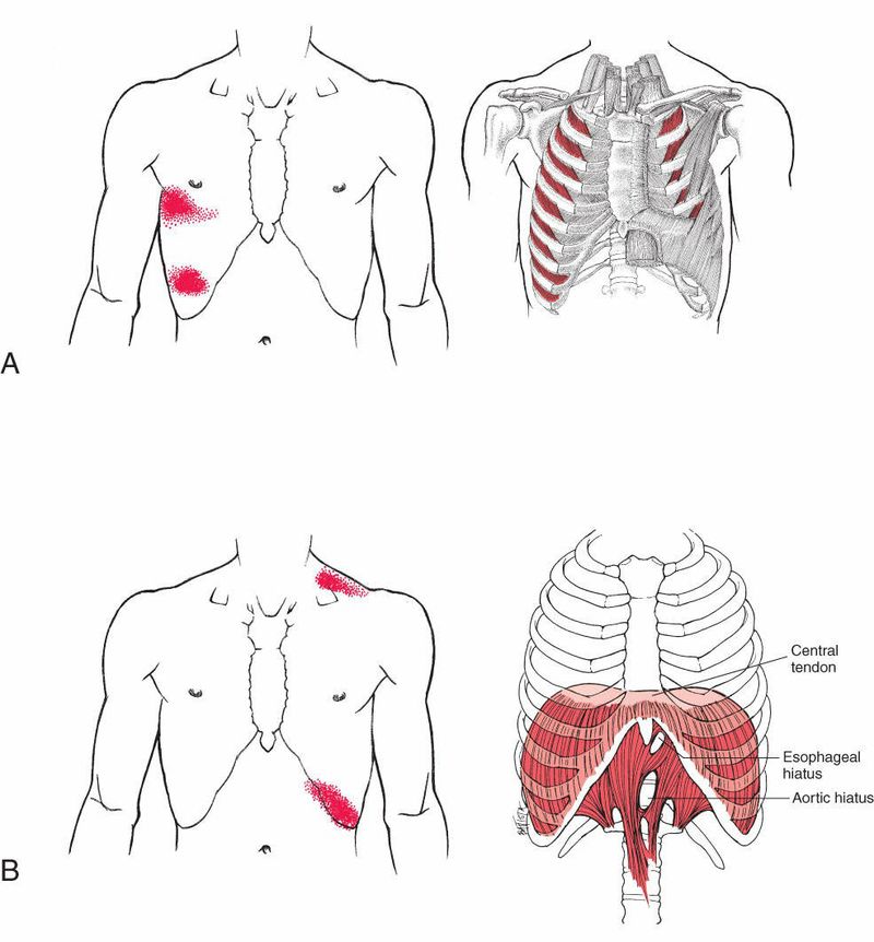Diaphragma - Afbeelding 9
