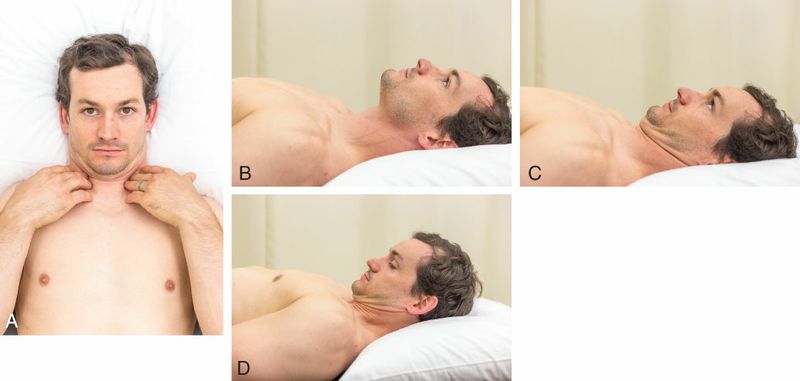 Digastricus - Afbeelding 6