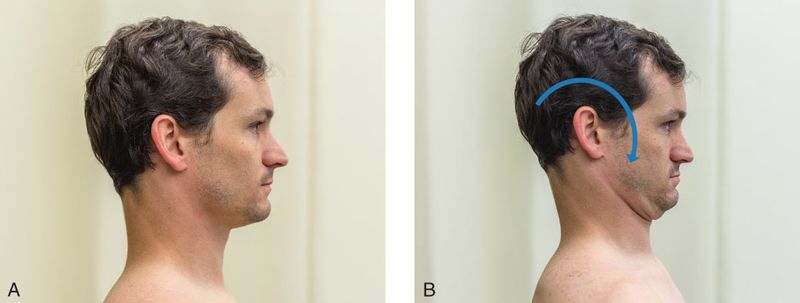 Digastricus - Afbeelding 7