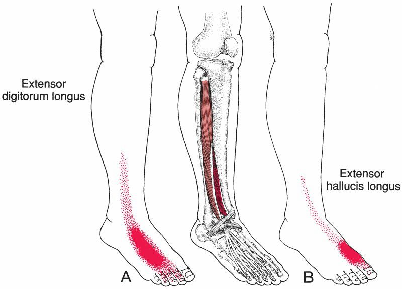 Extensor Digitorum Longus - Afbeelding 2