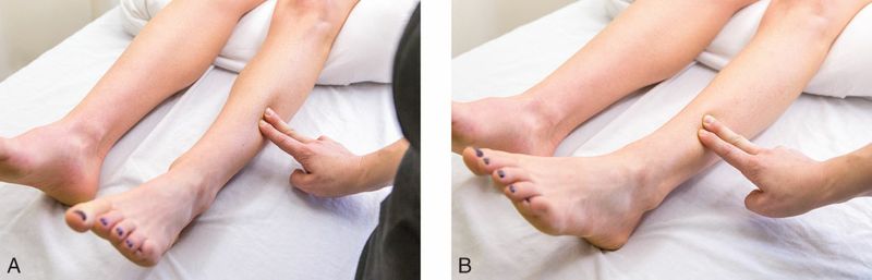 Extensor Digitorum Longus - Afbeelding 3