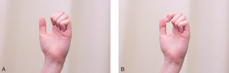 Extensor Digitorum - Afbeelding 3