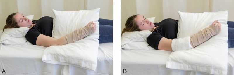 Extensor Digitorum - Afbeelding 5