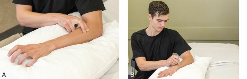 Extensor Digitorum - Afbeelding 6