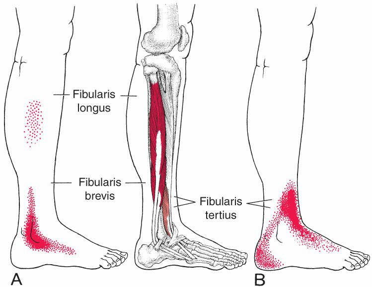 Fibularii - Afbeelding 3