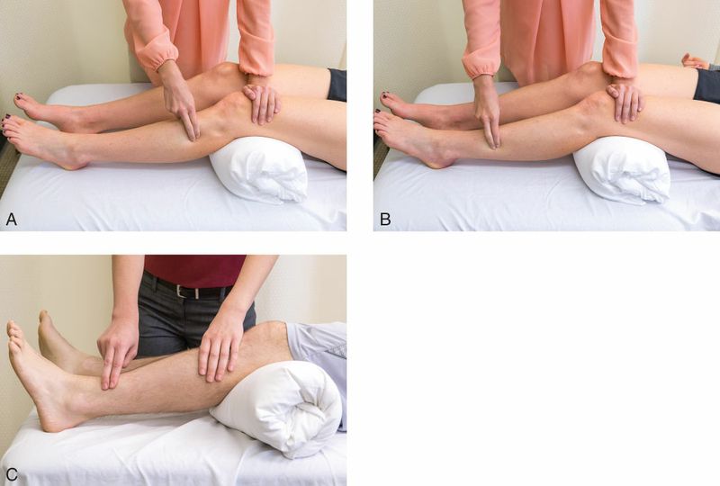 Fibularii - Afbeelding 4