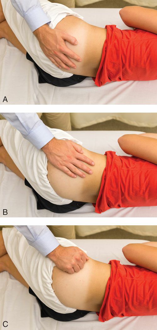 Gluteus Maximus - Afbeelding 10