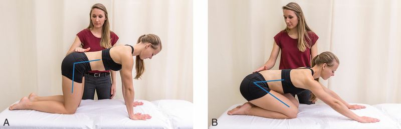 Gluteus Maximus - Afbeelding 4