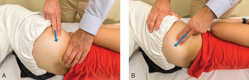 Gluteus Medius - Afbeelding 7