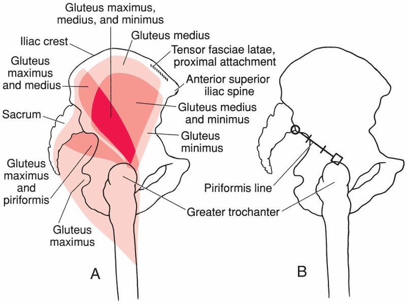 Gluteus Medius - Afbeelding 8