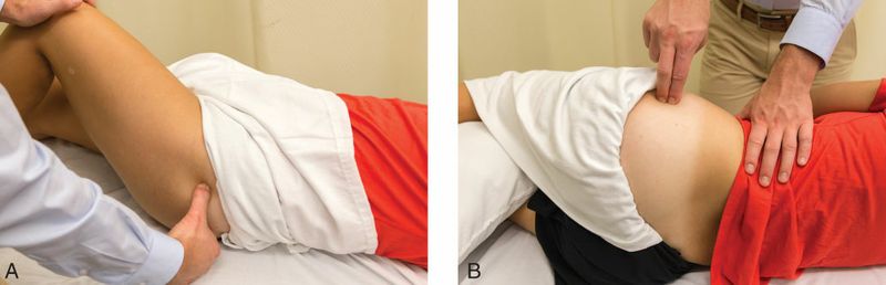 Gluteus Minimus - Afbeelding 7