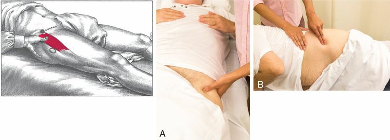 Gluteus Minimus - Afbeelding 8