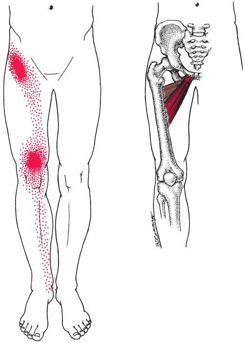 Gracilis - Afbeelding 6