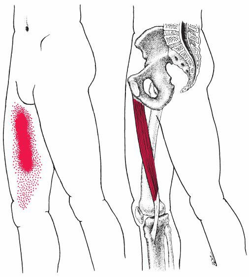 Gracilis - Afbeelding 8