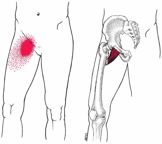 Gracilis - Afbeelding 9