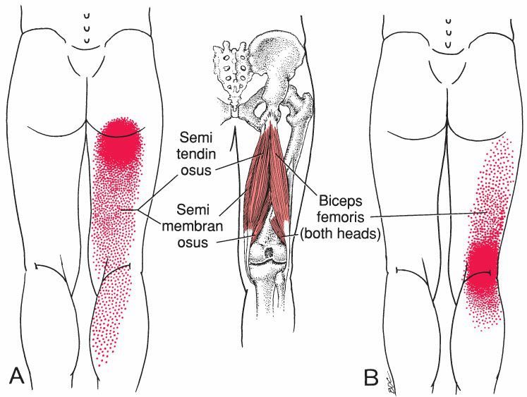 Hamstrings - Afbeelding 4
