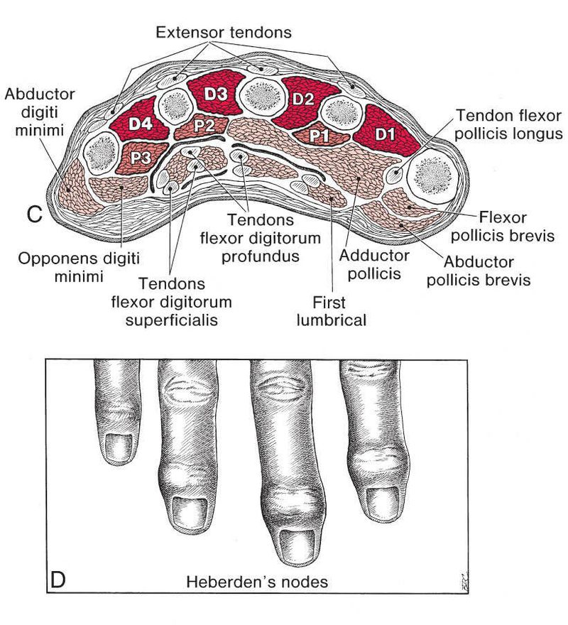 Interossei - Afbeelding 2