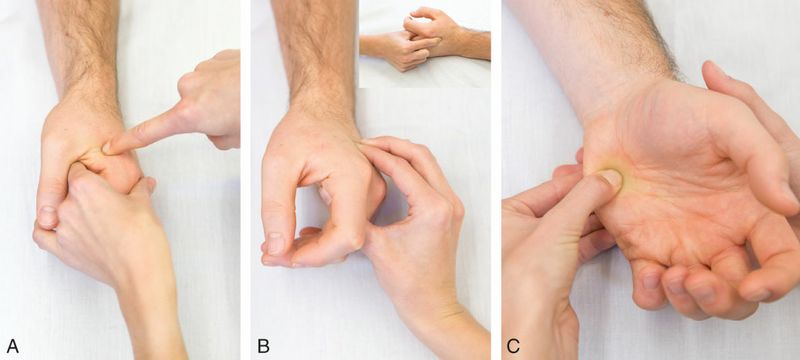 Interossei - Afbeelding 4