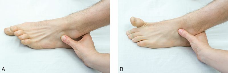 Intrinsieke Voetspieren - Afbeelding 13